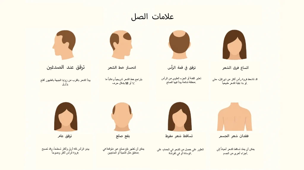 علامات الصلع