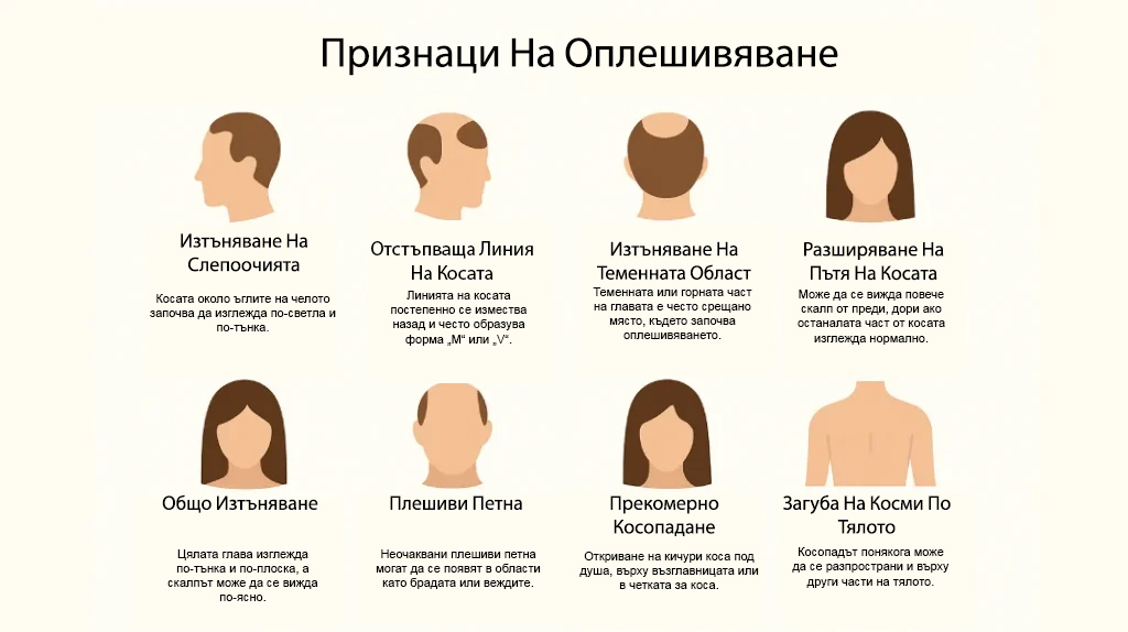 Започване На Оплешивяване