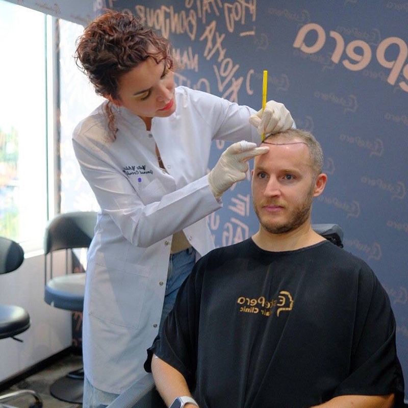 Was Ist Das Durchschnittsalter, In Dem Menschen Beginnen Kahl Zu Werden