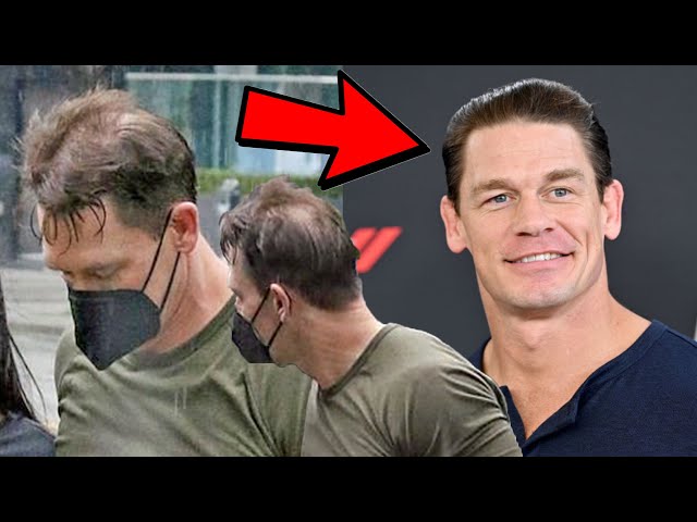 John Cena Haartransplantation Vorher Nachher