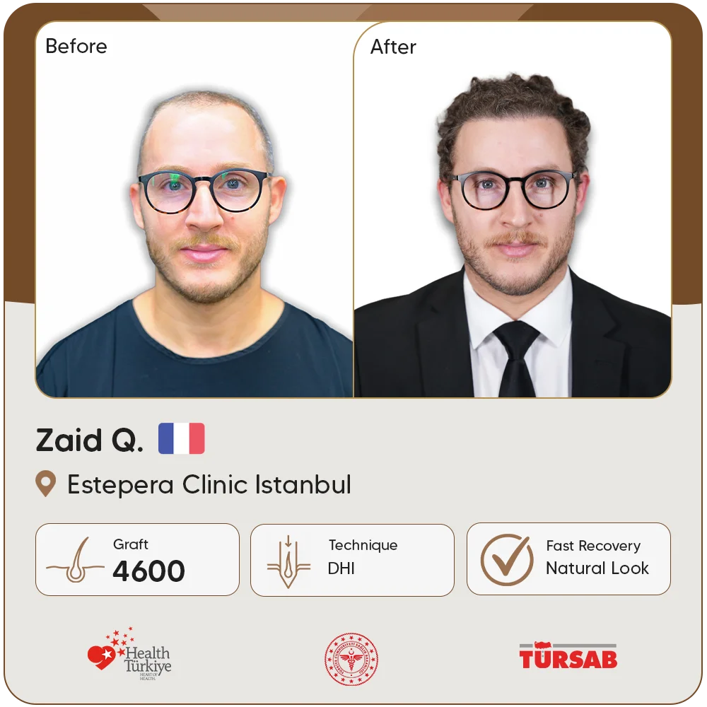 Haartransplantation Türkei