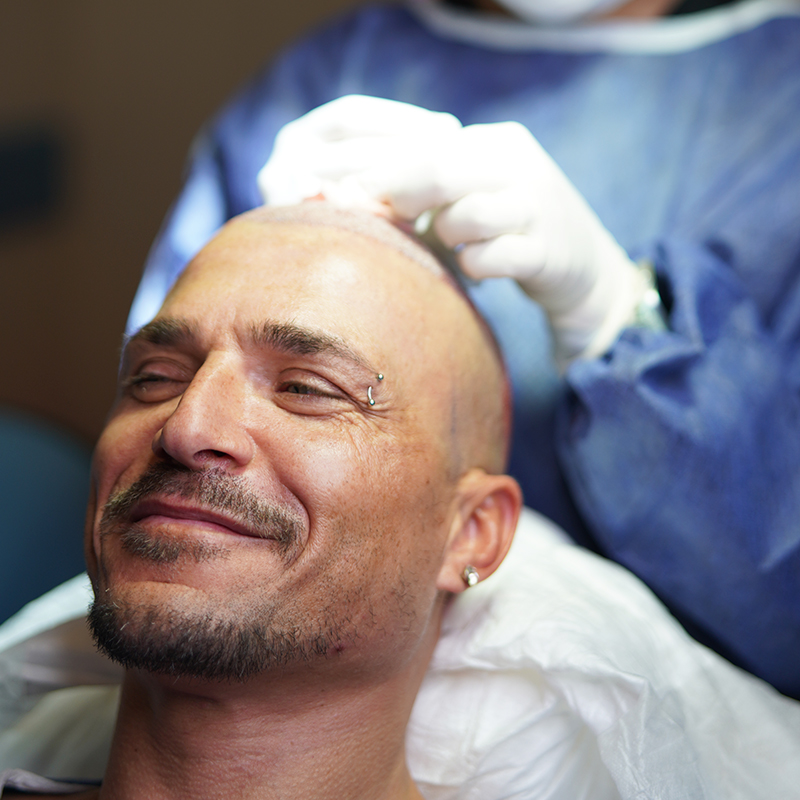 Cosas Que Debe Saber Sobre el trasplante de Cabello