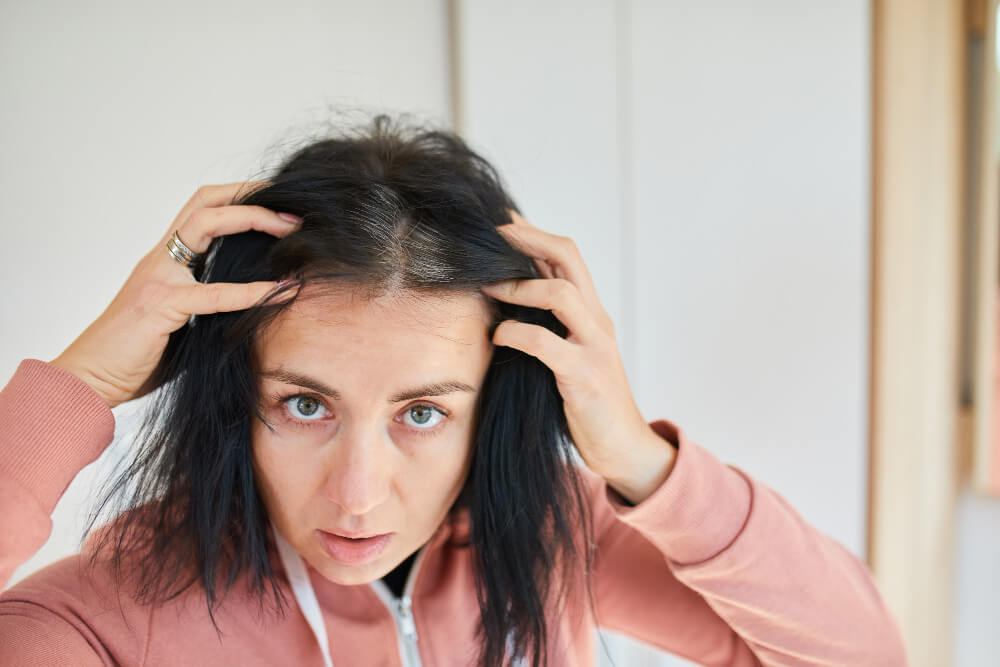 La Perte De Cheveux Chez Les Femmes