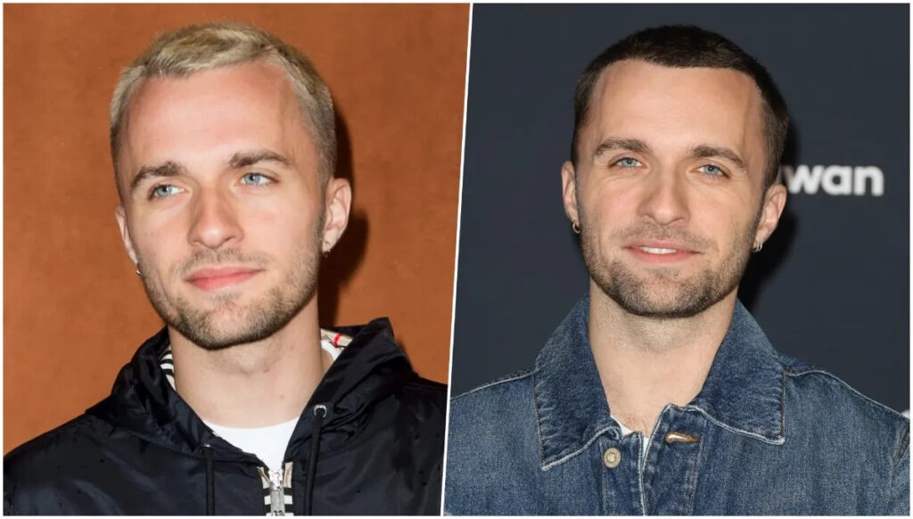 squeezie greffe cheveux