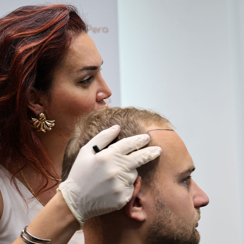 Πότε Μπορώ Να Βάψω Τα Μαλλιά Μου Μετά Από Μια Θεραπεία Μεταμόσχευσης Μαλλιών;