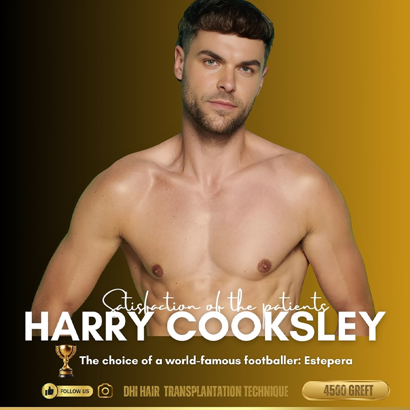 Αποκαλύφθηκε η μεταμόρφωση του Harry Cooksley μετά από μεταμόσχευση μαλλιών