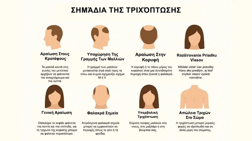 Σημάδια Τη ςΤριχόπτωσης