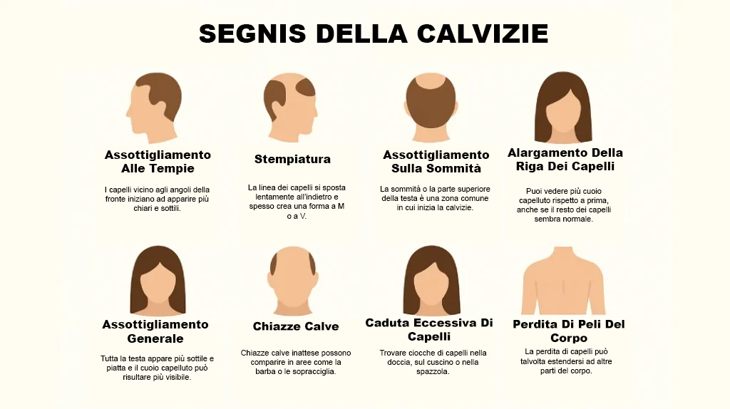 Segni Della Calvizie