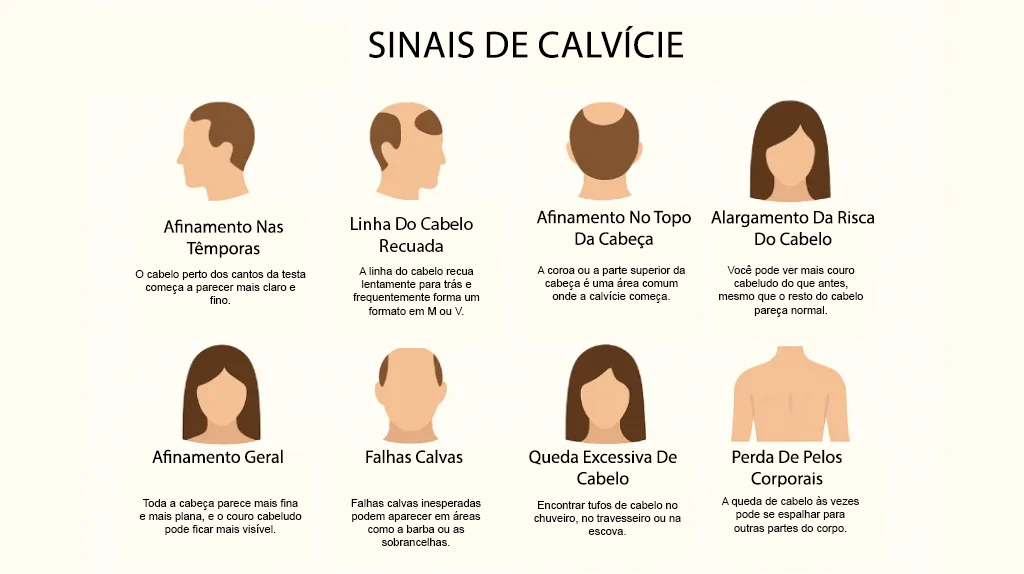 Começar A Ficar Calvo