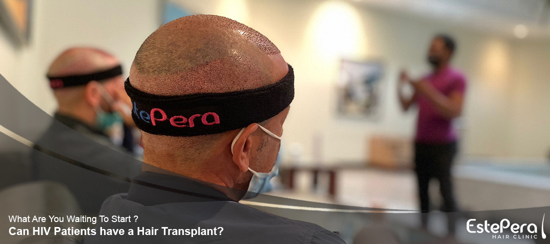 Hair Transplant for HIV Patients