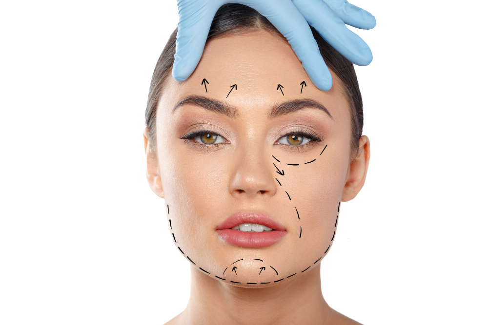 face lift surgery