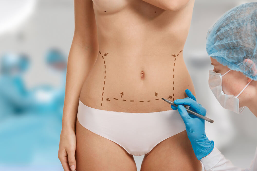 liposuction in turkey