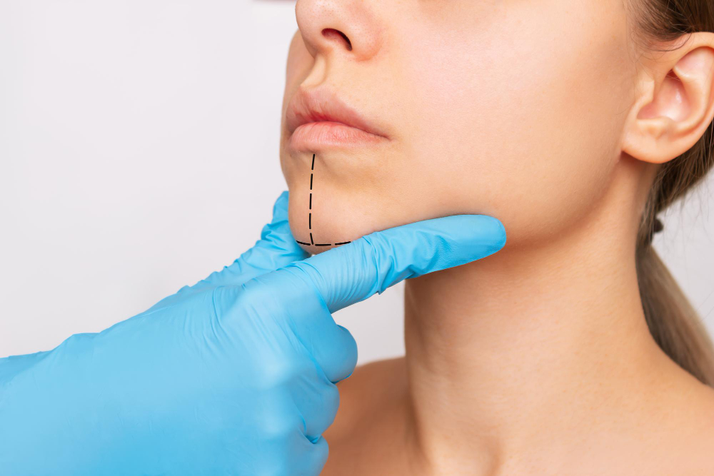 Corrective Jaw Surgery