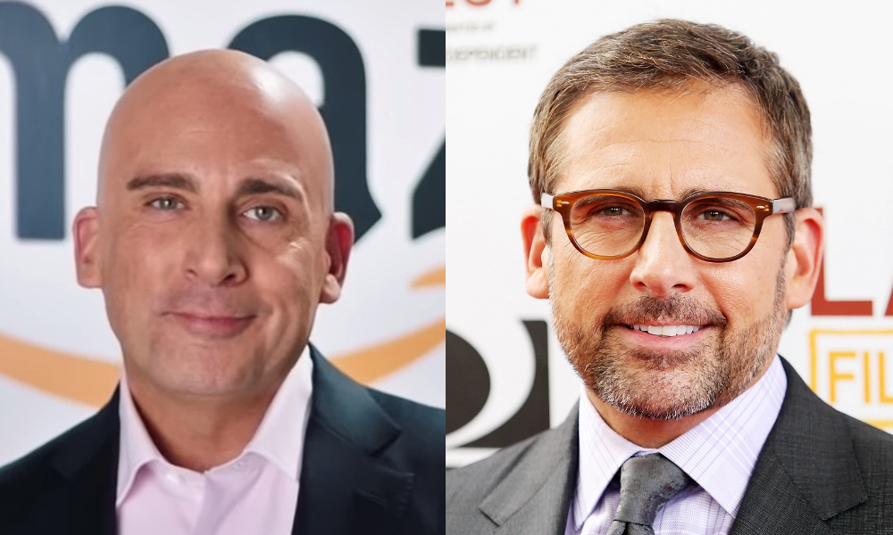 Celebrities With Hair Transplant AJ McLean, Steve Carell etc. Estepera Hair Clinic Best