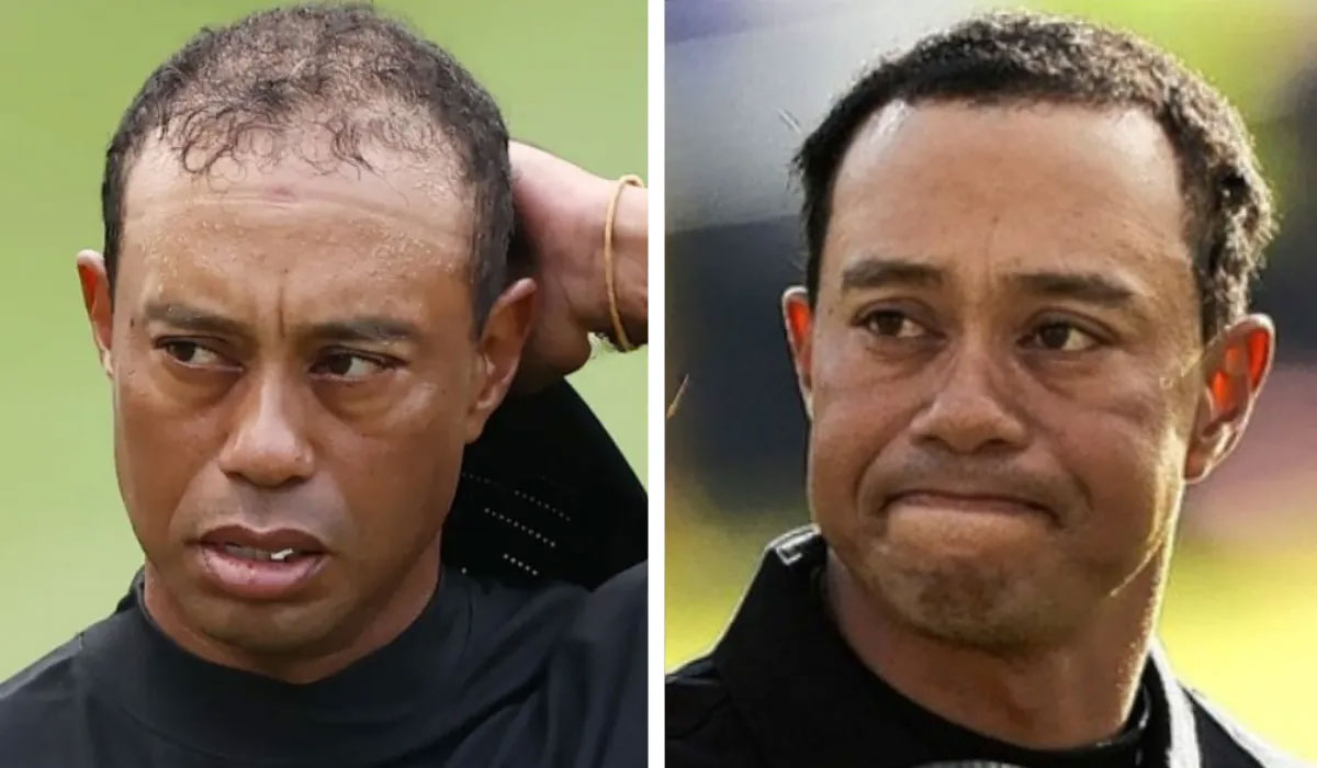 Tiger Woods Before After