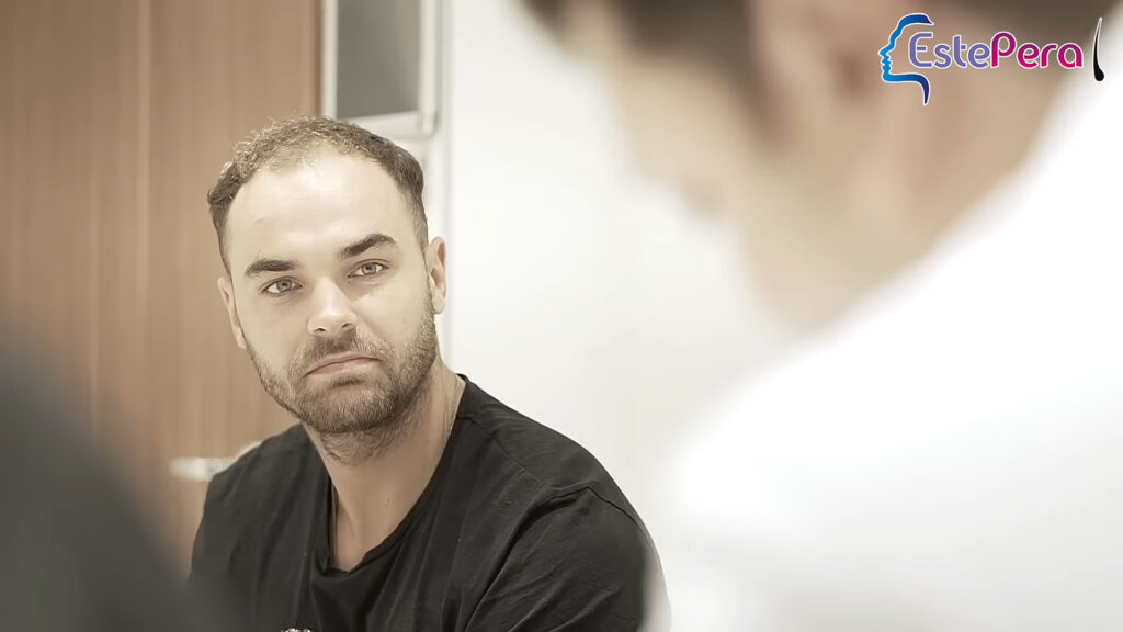 Harry Cooksley before Hair Transplant